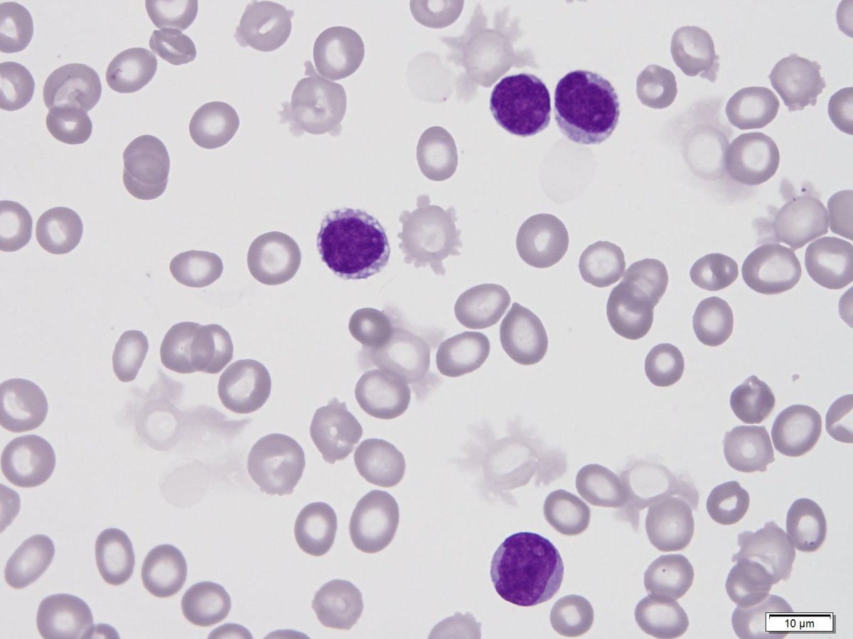 Figure 3 Blood 100x1